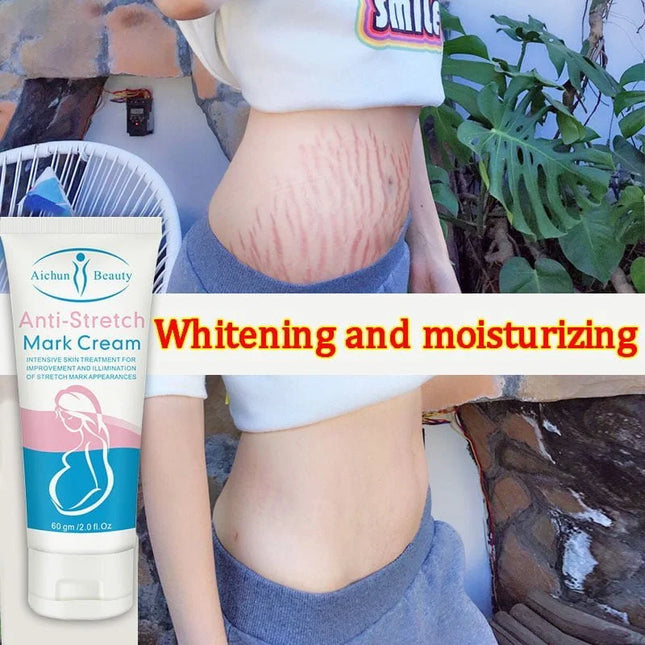 Stretch Mark (60g)