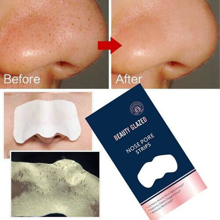 10 pc- Beauty Glazed Nose Strips